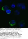 SARS-CoV-2 (COVID-19) Spike RBD Antibody