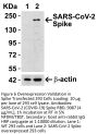 SARS-CoV-2 (COVID-19) Spike RBD Antibody