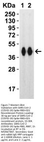 SARS-CoV-2 (COVID-19) Spike RBD Antibody