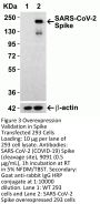 SARS-CoV-2 (COVID-19) Spike 681P Antibody