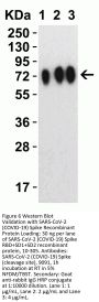 SARS-CoV-2 (COVID-19) Spike 681P Antibody