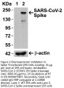 SARS-CoV-2 (COVID-19) Spike Antibody (cleavage site)