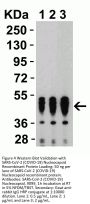 SARS-CoV-2 (COVID-19) Nucleocapsid Antibody