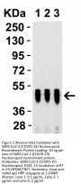 SARS-CoV-2 (COVID-19) Nucleocapsid Antibody