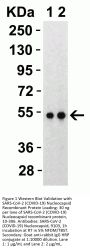 SARS-CoV-2 (COVID-19) Nucleocapsid Antibody