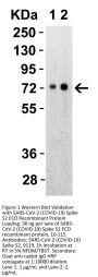 SARS-CoV-2 (COVID-19) Spike S2 Antibody