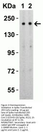 SARS-CoV-2 (COVID-19) Spike S2 Antibody