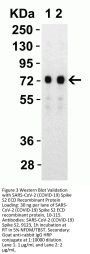 SARS-CoV-2 (COVID-19) Spike S2 Antibody