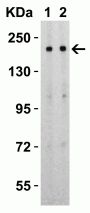 SARS-CoV-2 (COVID-19) Spike S2 Antibody