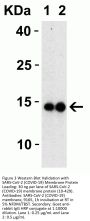 SARS-CoV-2 (COVID-19) Membrane Antibody