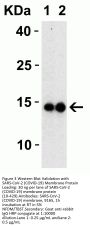 SARS-CoV-2 (COVID-19) Membrane Antibody