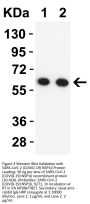 SARS-CoV-2 (COVID-19) NSP16 Antibody