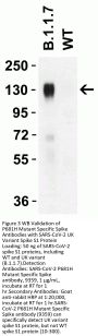 SARS-CoV-2 Spike P681H Antibody (Alpha, Mu Variant)