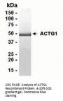 ACTG1 Recombinant Protein