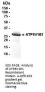 ATP6V1E1 Recombinant Protein