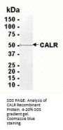 CALR Recombinant Protein