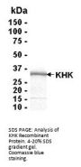 KHK Recombinant Protein