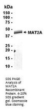 MAT2A Recombinant Protein
