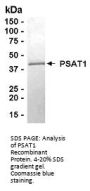 PSAT1 Recombinant Protein