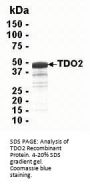 TDO2 Recombinant Protein