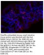Normal Rabbit Serum