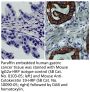 Mouse Anti-Cytokeratin 19-HRP