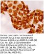 Goat Anti-Mouse IgG2b, Human ads-HRP