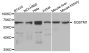 Anti-SQSTM1 antibody (1-440) (STJ110069)