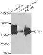 Anti-NCAM1 antibody (759-858) (STJ110222)