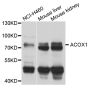 Anti-ACOX1 antibody (1-270) (STJ110391)