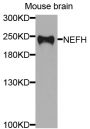 Anti-NEFH antibody (873-1020) (STJ110740)
