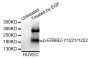 Anti-Phospho-ERBB2-Y1221/1222 antibody (STJ110863)