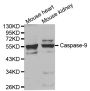 Anti-CASP9 antibody (139-416) (STJ110935)