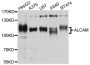Anti-ALCAM antibody (28-180) (STJ111130)