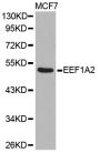 Anti-EEF1A2 antibody (184-463) (STJ111156)