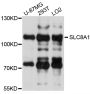 Anti-SLC8A1 antibody (600-700) (STJ111250)