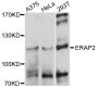 Anti-ERAP2 antibody (1-170) (STJ111527)