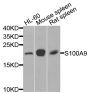Anti-S100A9 antibody (20-114) (STJ111884)