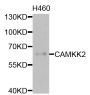 Anti-CAMKK2 antibody (1-100) (STJ111941)