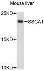 Anti-SSSCA1 antibody (1-199) (STJ112176)