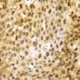 Anti-IRF3 antibody (100-200) (STJ112965)