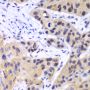 Anti-IRF3 antibody (100-200) (STJ112965)