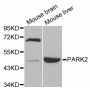 Anti-PRKN antibody (1-465) (STJ113001)