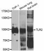 Anti-TLR2 antibody (600-700) (STJ113031)