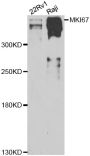 Anti-MKI67 antibody (700-800) (STJ113112)