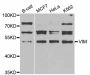 Anti-VIM antibody (300-400) (STJ113129)
