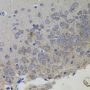 Anti-VIM antibody (300-400) (STJ113129)