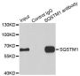 Anti-SQSTM1 antibody (1-440) (STJ113162)