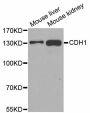Anti-CDH1 antibody (373-622) (STJ113165)