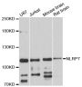 Anti-NLRP7 antibody (800-1000) (STJ113232)